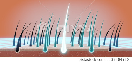 Hair follicles - regeneration concept - 3D illustration 133304510