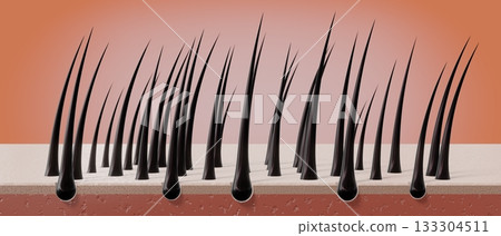 Healthy hair follicles and skin under microscope - 3D illustration Healthy hair follicles and skin under microscope - 3D illustration 133304511