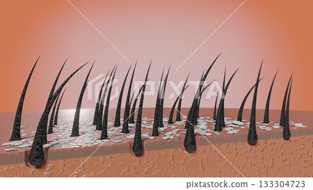Hair follicles and dandruff under microscope - 3D illustration 133304723