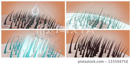 Hair follicles and dandruff - steps in therapy - 3D illustration Hair follicles and dandruff - steps in therapy - 3D illustration 133304758