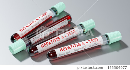 Hepatitis A virus - test tubes, blood tests - 3D illustration 133304977