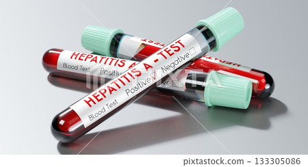 Hepatitis A virus - test tubes, blood tests - 3D illustration Hepatitis A virus - test tubes, blood tests - 3D illustration 133305086
