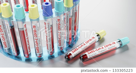 Coronavirus, SARS CoV 2, Covid 19 virus - test tubes, blood tests - 3D illustration Coronavirus, SARS CoV 2, Covid 19 virus - test tubes, blood tests - 3D illustration 133305223