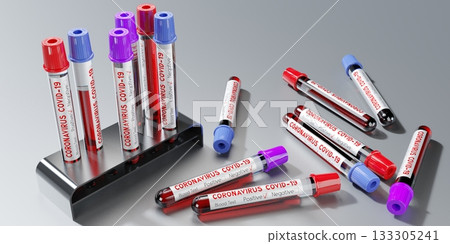 Coronavirus, SARS CoV 2, Covid 19 virus - test tubes, blood tests - 3D illustration 133305241