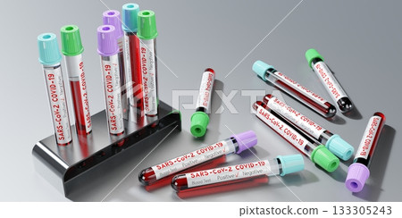 Coronavirus, SARS CoV 2, Covid 19 virus - test tubes, blood tests - 3D illustration 133305243