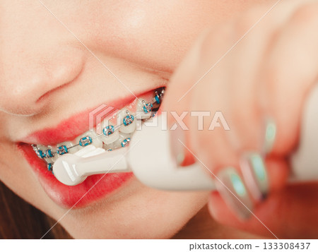 Woman smiling cleaning teeth with braces Woman smiling cleaning teeth with braces 133308437