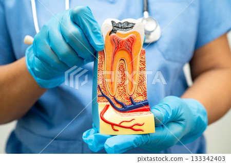 Dentist holding dental implant, artificial tooth roots into jaw, root canal of dental treatment, gum disease, teeth model for dentist. 133342403