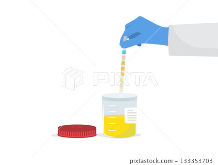 Urine analysis. Doctor in gloves holds an indicator strip in hands stock illustration 133353703