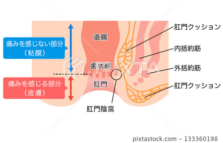 肛門的結構:直腸和肛門的橫切面 肛門的結構:直腸和肛門的橫切面 133360198