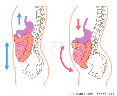 Visceroptosis: A condition in which the internal organs are lowered Visceroptosis: A condition in which the internal organs are lowered 133360533