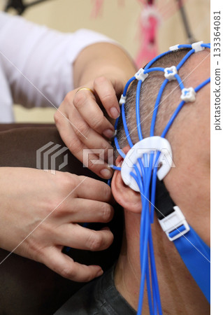 Electroencephalography (EEG) procedure. A noninvasive medical test that measures the brain's electrical activity. 133364081