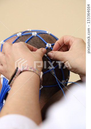 Electroencephalography (EEG) procedure. A noninvasive medical test that measures the brain's electrical activity. Electroencephalography (EEG) procedure. A noninvasive medical test that measures the brain's electrical activity. 133364084