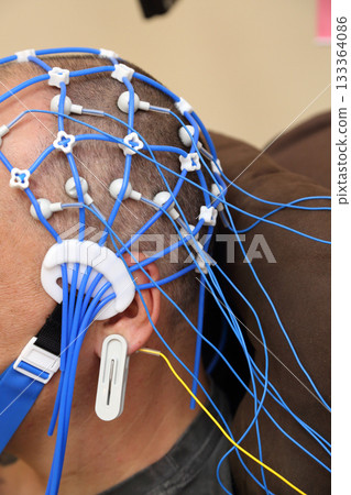 Electroencephalography (EEG) procedure. A noninvasive medical test that measures the brain's electrical activity. 133364086