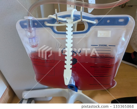 Blood is leaking from the urine. 133365868