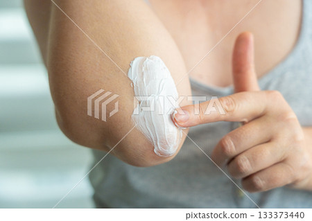 Cream on elbow skin. Applying the lotion to dry rough hands skin, elbow moisturizing creme Cream on elbow skin. Applying the lotion to dry rough hands skin, elbow moisturizing creme 133373440