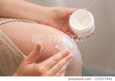Cream on knee skin. Applying the lotion to dry rough legs skin, elbow moisturizing creme Cream on knee skin. Applying the lotion to dry rough legs skin, elbow moisturizing creme 133373442