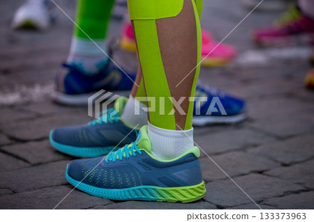 Close-up runner legs in kinesiotaping before marathon run Close-up runner legs in kinesiotaping before marathon run 133373963