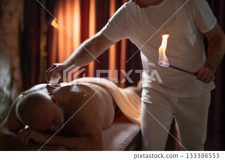 Close up of a traditional fire cupping therapy session with glass cups placed on a patients back and therapist using fire to create suction, promoting relaxation and healing. Close up of a traditional fire cupping therapy session with glass cups placed on a patients back and therapist using fire to create suction, promoting relaxation and healing. 133386553