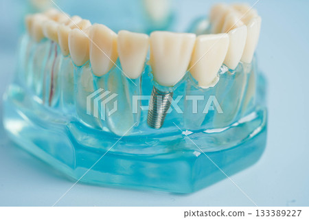 Dental teeth model on white background for learn about dentistry. 133389227