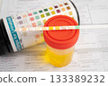 Urinalysis, urine cup with reagent strip pH paper test and comparison chart in laboratory. 133389232