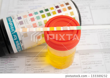 Urinalysis, urine cup with reagent strip pH paper test and comparison chart in laboratory. Urinalysis, urine cup with reagent strip pH paper test and comparison chart in laboratory. 133389232