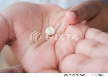 Child shows off a lost tooth in their palm 133389806