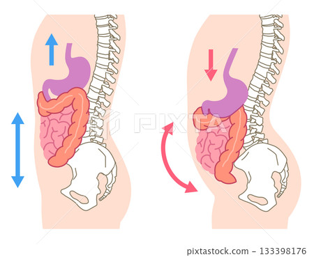 Visceroptosis: A condition in which the internal organs are lowered 133398176