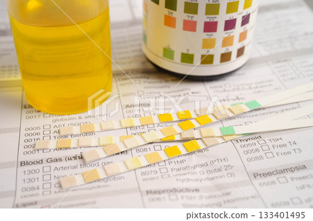 Urinalysis, urine cup with reagent strip pH paper test and comparison chart in laboratory. 133401495
