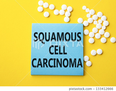 Squamous Cell Carcinoma symbol. Concept words Squamous Cell Carcinoma on blue note. Beautiful yellow background with pills. Healthcare and Squamous Cell Carcinoma concept. Copy space. Squamous Cell Carcinoma symbol. Concept words Squamous Cell Carcinoma on blue note. Beautiful yellow background with pills. Healthcare and Squamous Cell Carcinoma concept. Copy space. 133412666