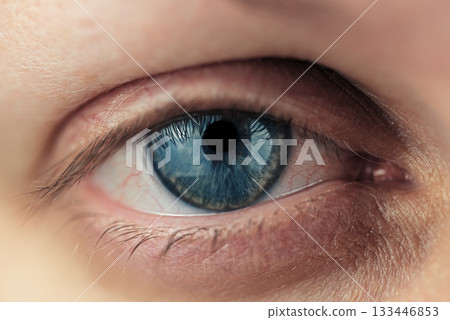 A close up of a person's eye with a blue iris 133446853