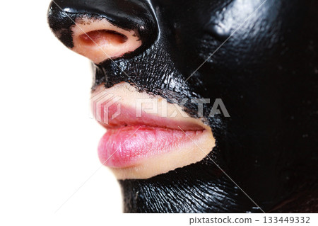 Girl black carbo peel off mask on face Girl black carbo peel off mask on face 133449332