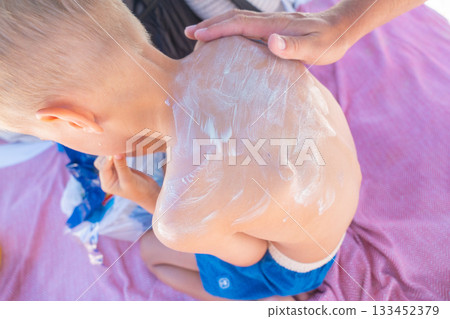 A child sitting on a beach towel while sunscreen is being applied to their back. The close-up scene conveys summer care, sun protection, and a family day at the seaside on a bright sunny vacation A child sitting on a beach towel while sunscreen is being applied to their back. The close-up scene conveys summer care, sun protection, and a family day at the seaside on a bright sunny vacation 133452379