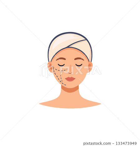 Woman undergoing cosmetic surgery preparation showcases facial markings for refined aesthetic 133473949