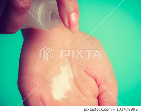 Woman putting white cream on hand 133479999