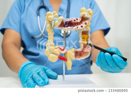 Intestine, Asian woman holding human anatomy model. 133480895