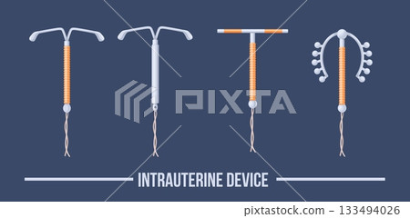 Iud types. Copper intrauterine contraceptive device, mirena coil iucd uterine implant placement hormonal birth control method contraception equipment set neat vector illustration Iud types. Copper intrauterine contraceptive device, mirena coil iucd uterine implant placement hormonal birth control method contraception equipment set neat vector illustration 133494026