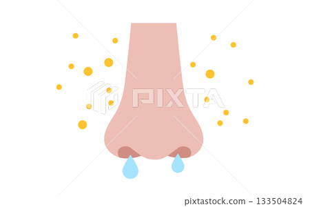 Allergic rhinitis poster Allergic rhinitis poster 133504824