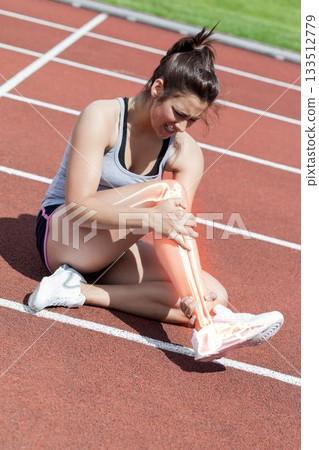 Highlighted bones of woman suffering from leg pain Highlighted bones of woman suffering from leg pain 133512779