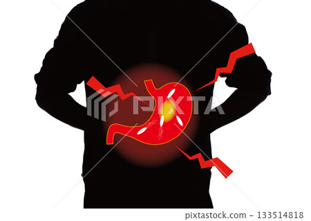 胃病、幽門螺旋桿菌、胃潰瘍 133514818