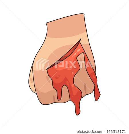 illustration of bleeding illustration of bleeding 133518171