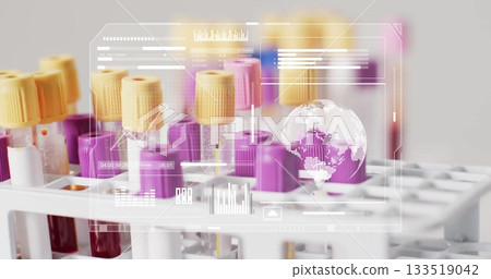 Displaying white plastic rack holding blood tubes with color-coded caps at lab, digital overlay 133519042
