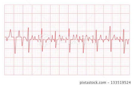 Electrocardiogram Heartbeat Waveform on Grid paper Electrocardiogram Heartbeat Waveform on Grid paper 133519524