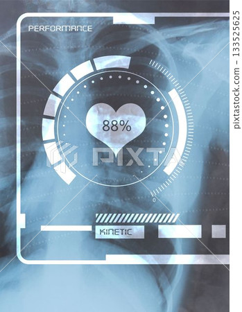 Medical interface on xray Medical interface on xray 133525625