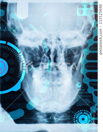 Digitally generated image of human skull X-ray 133525698