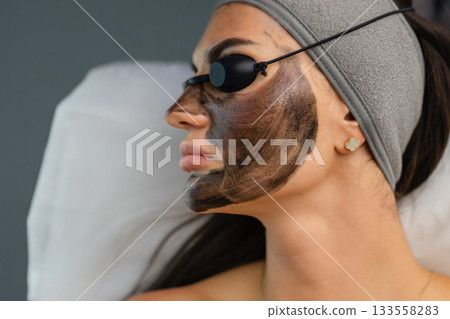 Woman undergoing a carbon laser facial procedure with a black carbon mask and protective eyewear in a beauty clinic. 133558283