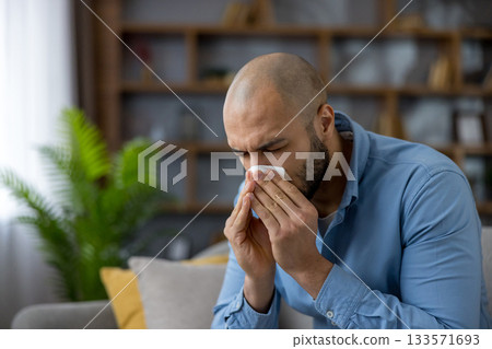 Sad man sitting on a sofa at home during cold and flu season, blowing his nose with a tissue, looking unwell and fatigued from runny nose and nasal congestion 133571693
