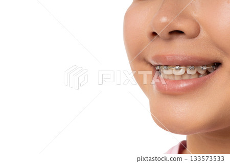 Spa and skin care enhance beauty and wellness for all, isolated, PNG 133573533