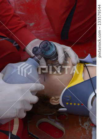 Emergency worker paramedic keeping an oxygen mask and cushion on sufferer face. Artificial respiration 133579544