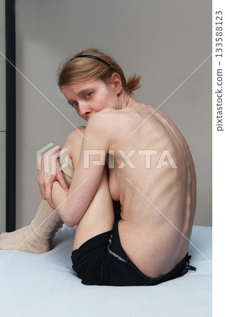 Protruding bones 133588123
