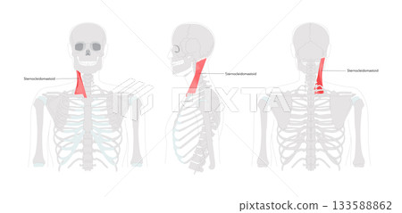Sternocleidomastoid - Human neck muscle labeled anatomy chart, with two heads originating from sternum and clavicle, 133588862